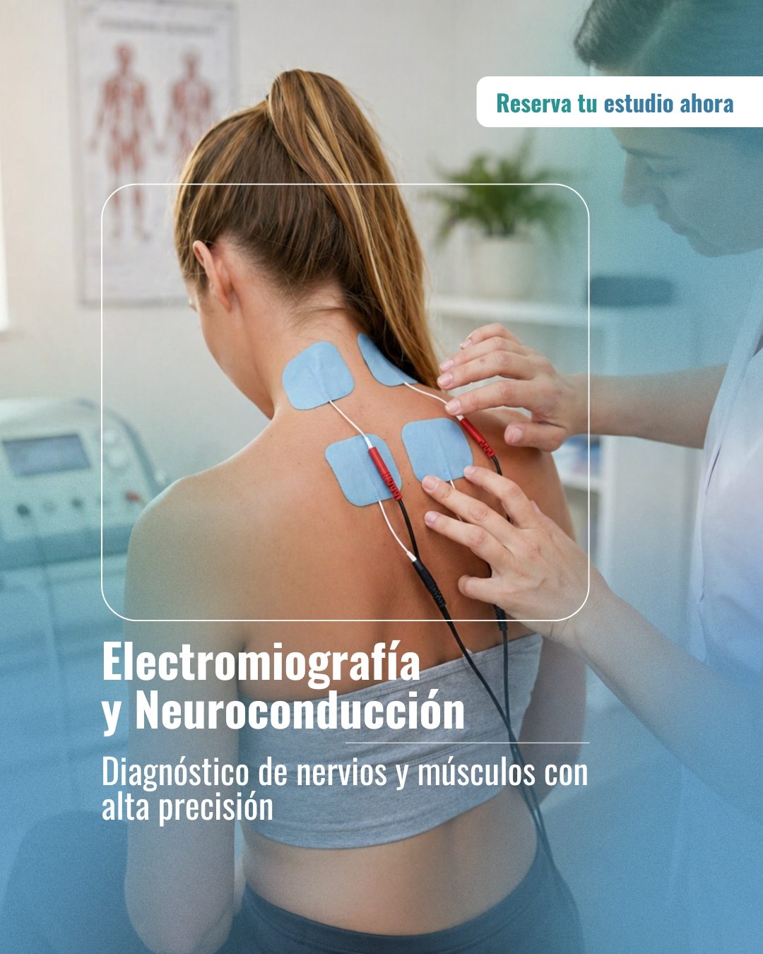 Electromiografía- Neuroconduccion-instituto-del-cerebro